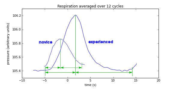 comparison of respiration waveforms